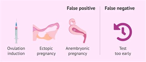 False negative and false positive pregnancy test .